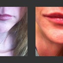 another before and after