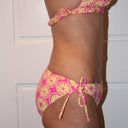 6 month post op 