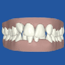 my clincheck animation