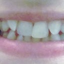 front view, smiling