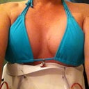 postop day two 475ml implants saline