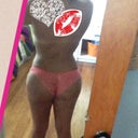 2 weeks post op! I swear pics don't do it justice! And I'm taking my own pics so its hard. Stickers r to cover my back tats!