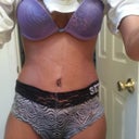 4 weeks post op