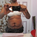 Pre op pics