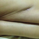 Inner legs appeared like this - 1st April