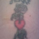 Tattoo before laser
