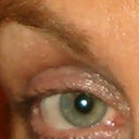 Before Latisse ...