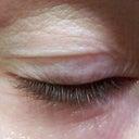 AFTER .. 10 WEEKS .. No makeup on
