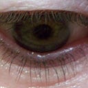 AFTER .. 10 WEEKS .. No makeup on