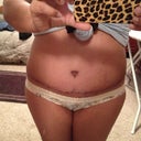 This was 3 weeks after surgery
