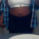 AFTER W/ SURGERY BRA