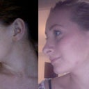Thursday 11th October 2012 
Before & After