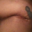 right hip almost 7wks
