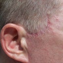 FACIAL PLASTIC SURGERY RESULTS