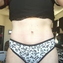 almost 7 months post op - With undies hiding the side bulges.  Not that bad.