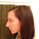 Morning of surgery, really shows the bump lol (taken December 19, 2011)