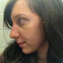Immediately after cast removal :) (taken December 27, 2011)
