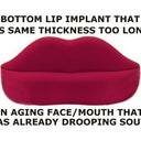 An aging face with downturned mouth is not helped by a lip implant that makes the bottom lip look straight all the way across, or making the lip corners look more downturned.