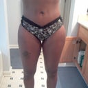 6 weeks post op woke up flat usually is in mornings front view although top looks swollen