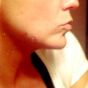 Profile before