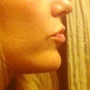Profile after