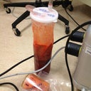 My liposuction canister