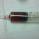 Seroma sucked out