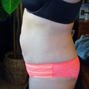 7 Weeks Post OP