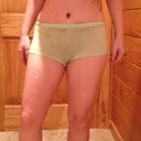 PO Day 5 swollen not standing straight but starting to look good.
