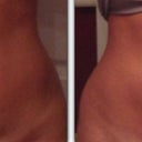 Morning of vs. 8 weeks post