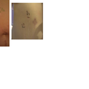 Belly button comparison