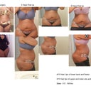 Before and After