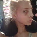 2 days after surgery- I can already see the difference in the tip!