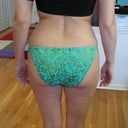 pre-op look at the cellulite and flanks!