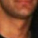 Before. Long. Sharp. Protruding. Pointed. Upturned voluminous Chin. Cheeks "full" meeting Lip-Ends