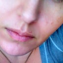 1 month after
