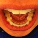 Bottoms with permanent retainer