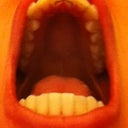 uppers with permanent retainer