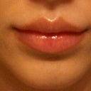 after filler in lips