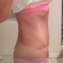 22 weeks, getting flatter