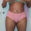 4 Weeks PO and feeling fine.