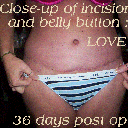 36 days post op ~ close-up insicion/scar & bb ~ LOVE how I look :)