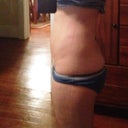 Week 2 after surgery.