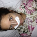 A few hours after surgery
