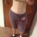 Day 4 Post Op