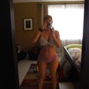 At 5 months post op