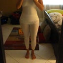 At 5 months post op