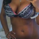 Love my new additions this was 2 years after my surgery