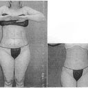 Front view before and after