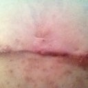 Pretty sure that's the top of my belly button ring hole